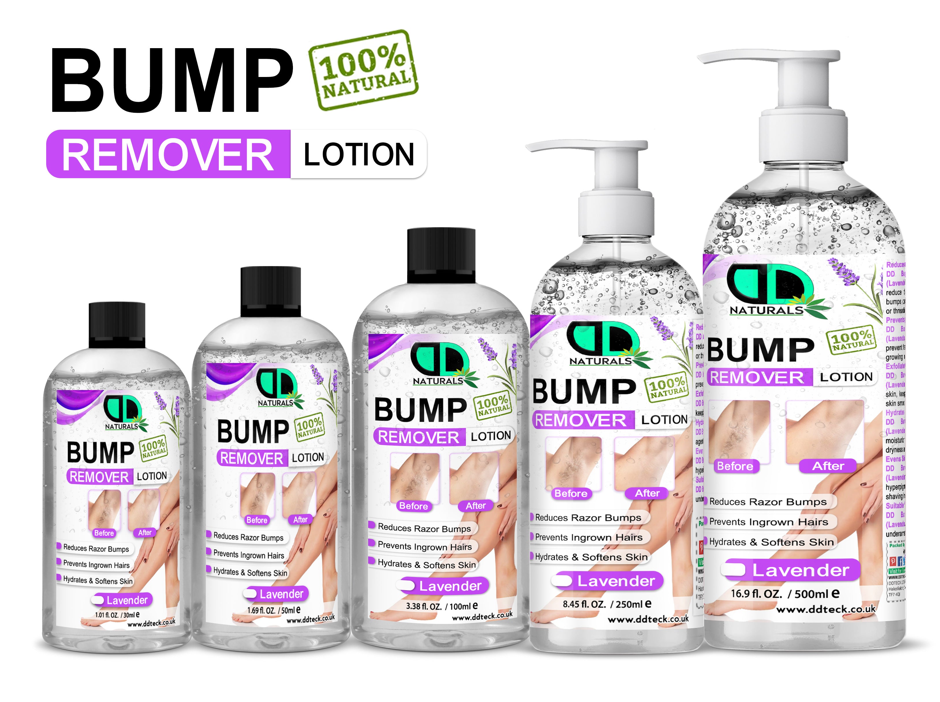 Lavender Bump Remover Lotion – 100% Natural Ingrown Hair Treatment